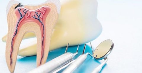 Dental Abscess Belmont WA | Epsom Dental Care