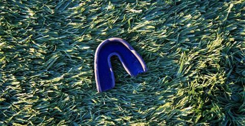 Mouthguards and Splints Belmont WA | Epsom Dental Care