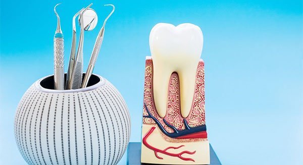 root canal treatment blurb belmont wa