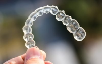 10 things to know before getting Invisalign®