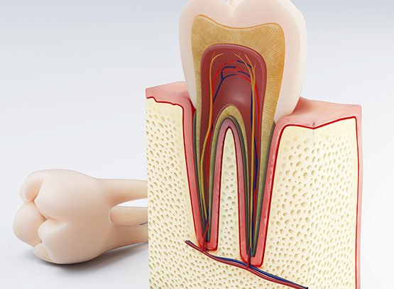 root canal treatment belmont wa