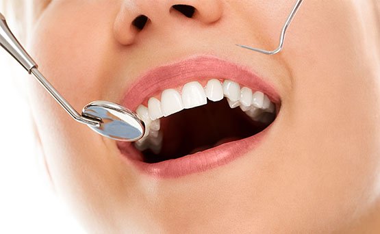 types of tooth wear belmont wa