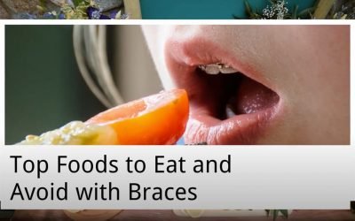 Top Foods to Eat and Avoid with Braces from Epsom Dental Care