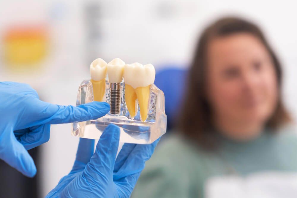 dental implants belmont wa 8 long-term benefits for missing teeth