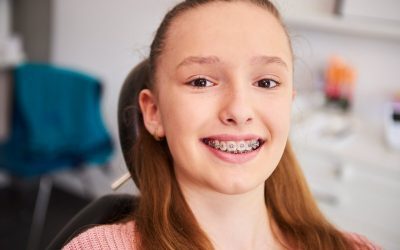 6 Things You Should Do Before Getting Braces