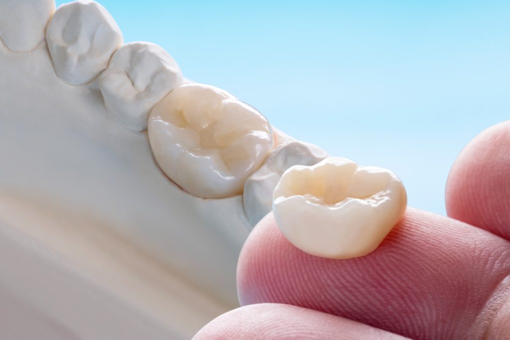 how long will dental crowns last