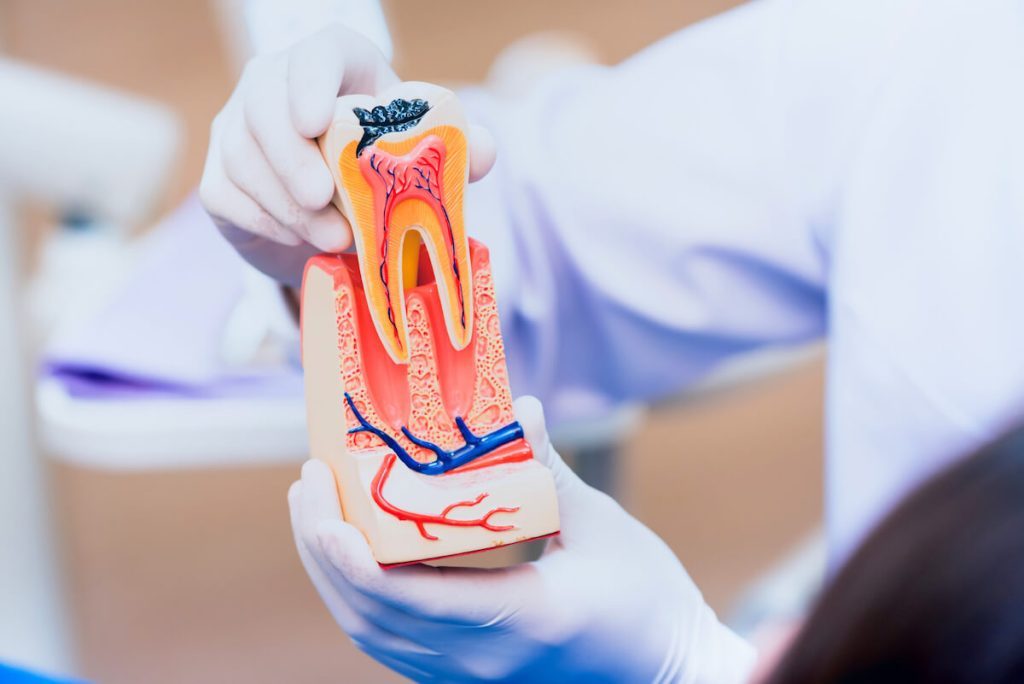 saving your natural tooth the importance of root canal treatment