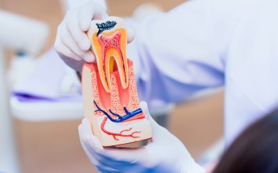 Saving Your Natural Tooth: The Importance of Root Canal Treatment