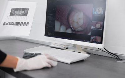 How Dental X-Rays Help Detect Problems Before They Start