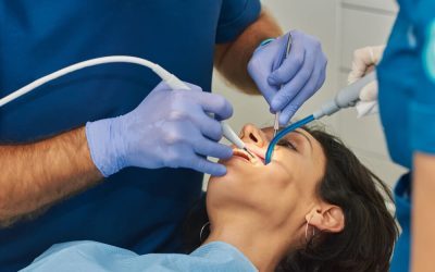 Scale and Clean: Advanced Tips & Common Questions