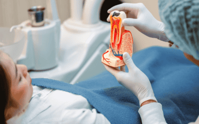 Root Canal Cost: What Affects the Price and Your Options