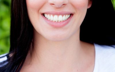 Dental Veneers: Types, Procedure and What to Expect