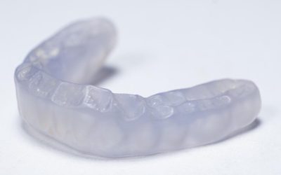 Night Guards for Teeth Grinding: How They Work and Who Needs One